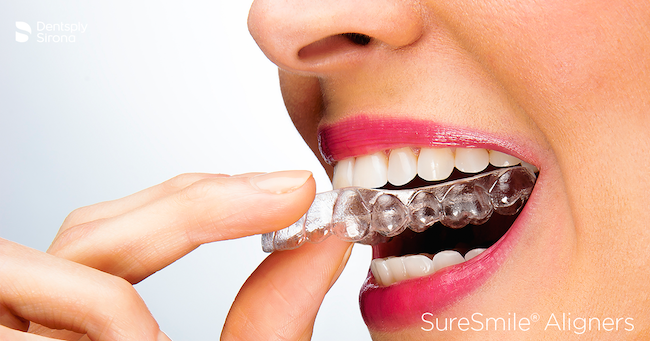 SureSmile Clear Aligners in Hoffman Estates